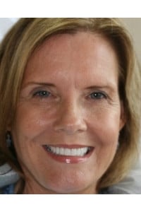 Konig Center for Cosmetic & Comprehensive Dentistry smile photos